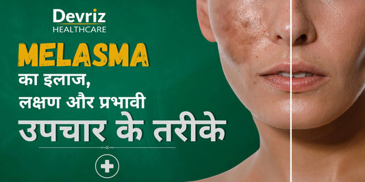 Melasma Treatment: Causes, Symptoms, and Effective Solutions