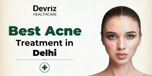 Best Acne Treatment Kit in Delhi