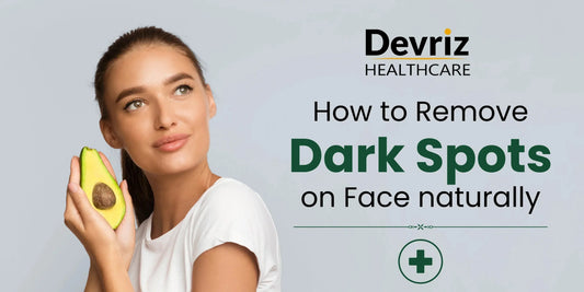 Dark spots on face