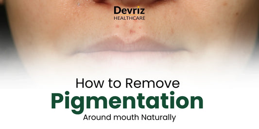 Pigmentation Around Mouth