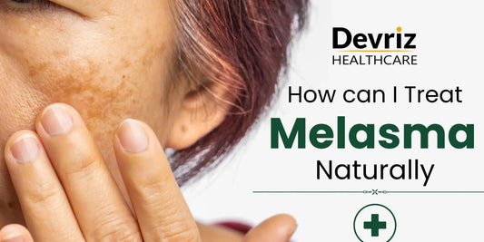 Melasma