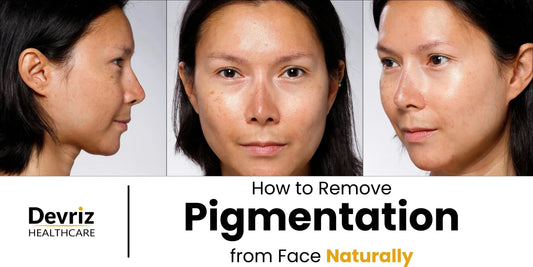 Pigmentation from Face
