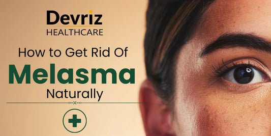 Rid of Melasma
