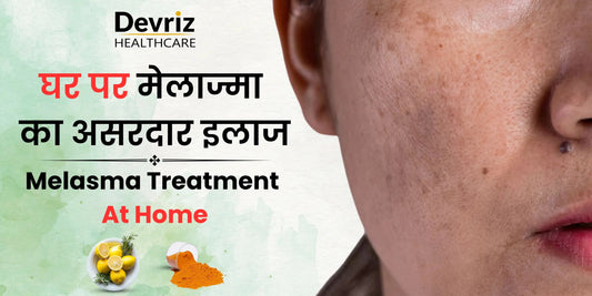 melasma treatment at home, hyperpigmentation treatment at home, pigmentation treatment at home, home remedies for pigmentation, natural melasma treatment,