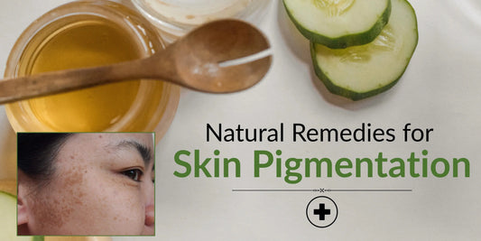 Skin Pigmentation