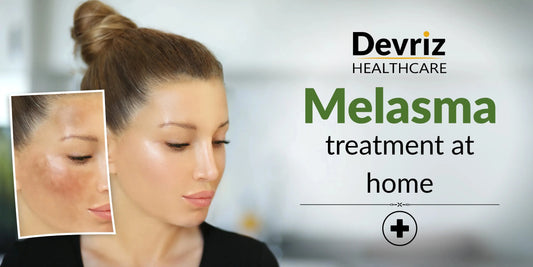 Melasma