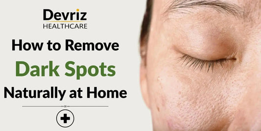How to Get Rid of Dark Spots Naturally at Home