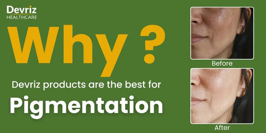 Why-Devriz-Products-Are-the-Best-for-Pigmentation Devriz Healthcare