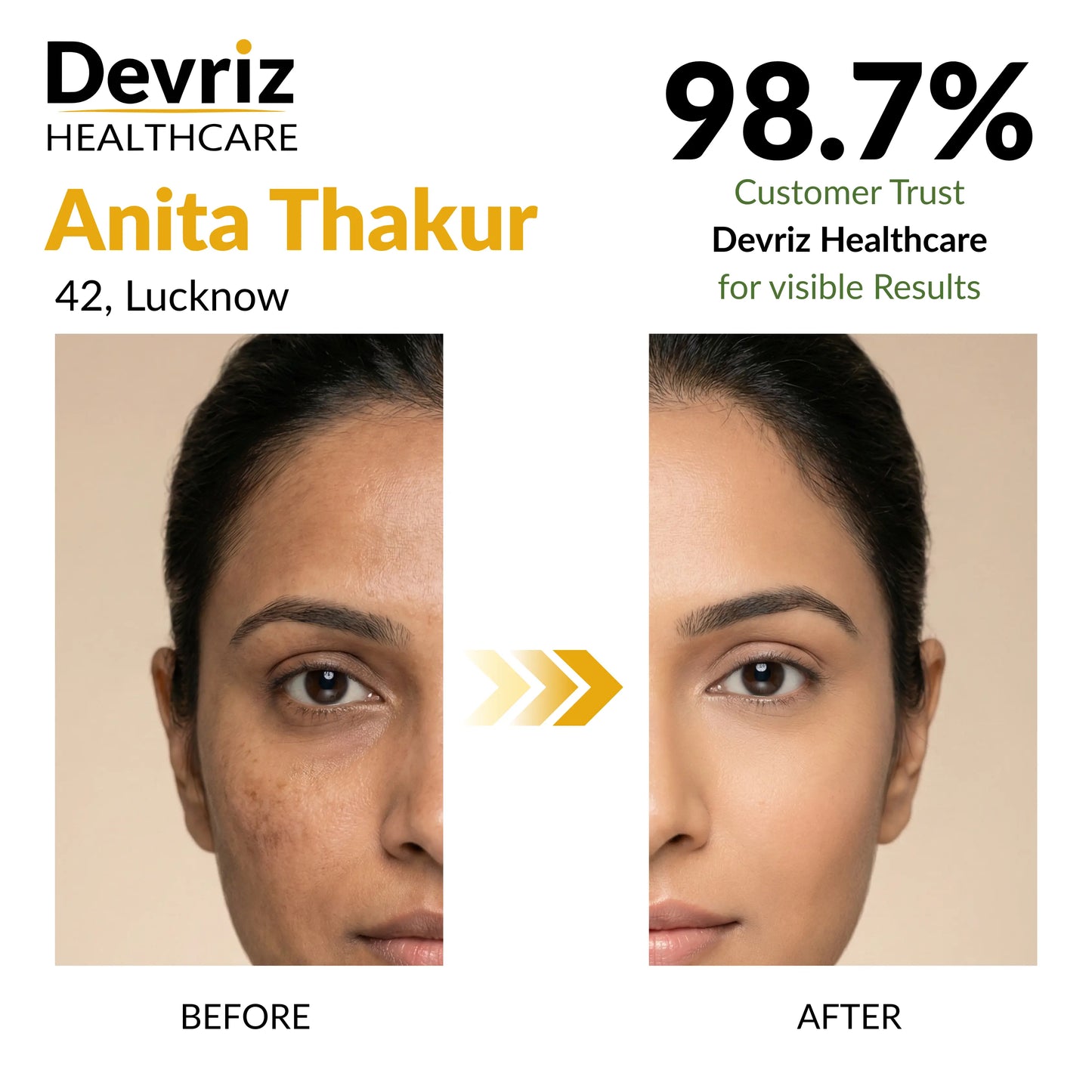 Mini Pigmentation Kit for Dark Spots & Uneven Skin Tone Devriz Healthcare