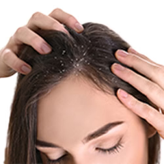 Dandruff