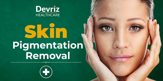 Skin Pigmentation Removal cream