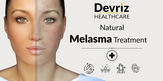 Melasma
