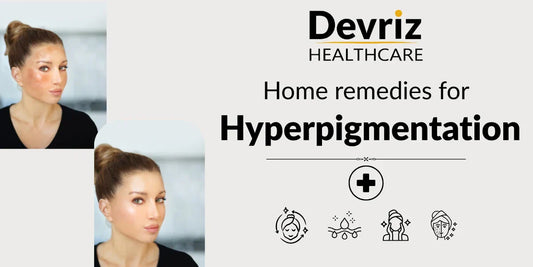 Hyperpigmentation 