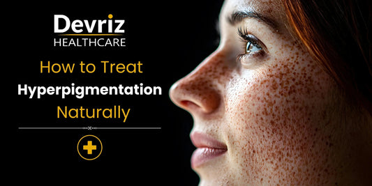 Hyperpigmentation 