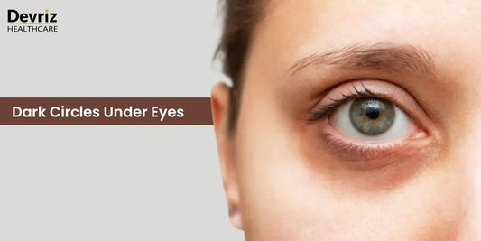How To Get Rid Of Dark Circles Under Eyes