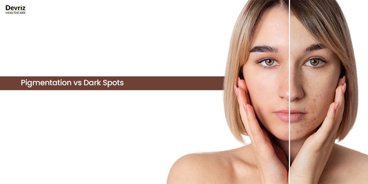 Pigmentation vs Dark Spots