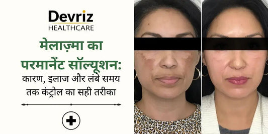 म-ल-ज-म-क-परम-न-ट-स-ल-य-शन-क-रण-इल-ज-और-ल-ब-समय-तक-क-ट-र-ल-क-सह-तर-क Devriz Healthcare