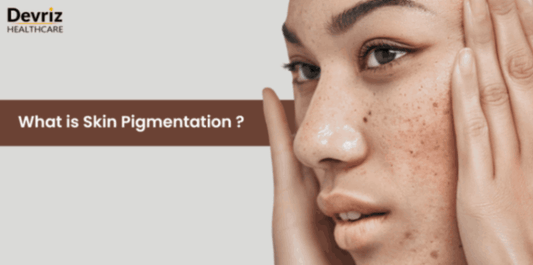 What is Skin Pigmentation