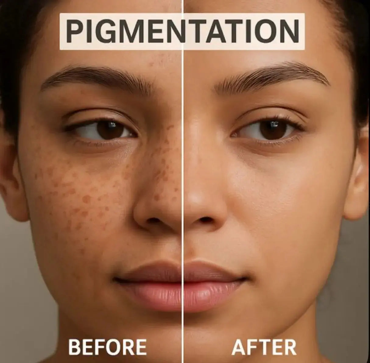 Anti-pigmentation Treatment kit Devriz Healthcare